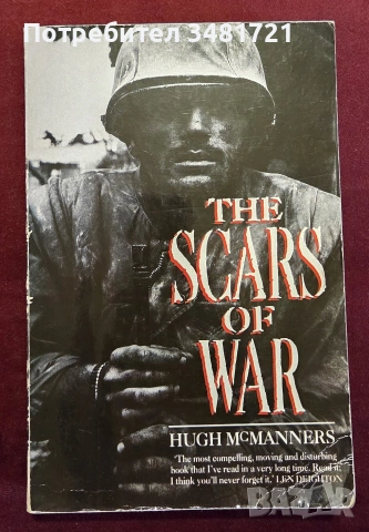 The Scars of War