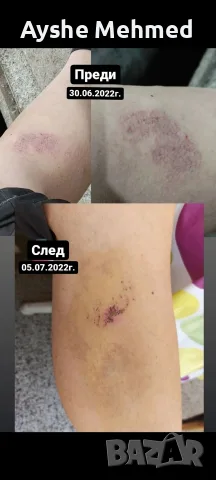 Профилактичен крем със змийска мас Профилактичен крем със змийска мас хидратира и омекотява кожата н, снимка 3 - Други - 55703139