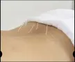 Домашна  Рехабилитация и Масажи , снимка 2