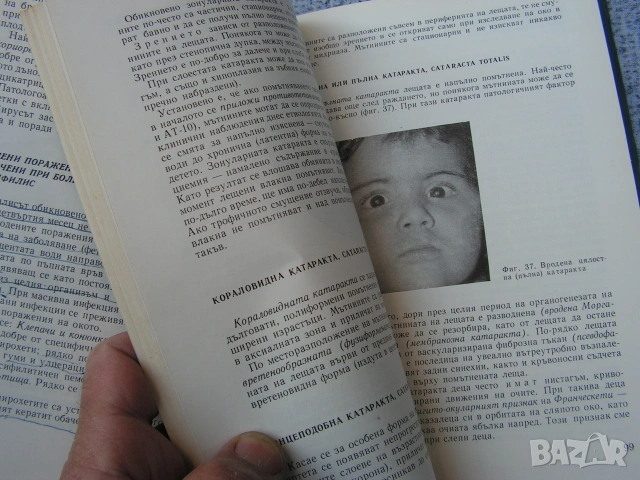 Офтамология , лот от уччебници и специализирана литература., снимка 15 - Учебници, учебни тетрадки - 55250988