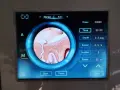 RF микронидлинг апарат 2 in 1 Microneedle козметичен уред, снимка 5
