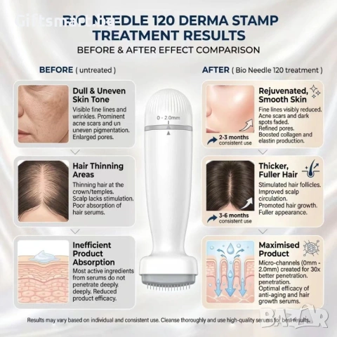 Продукт за грижа за лицето Derma Stamp - Bio Needle, 120 игли, регулируема дълбочина 0.5-2.0 mm, за , снимка 3 - Козметика за лице - 54658610