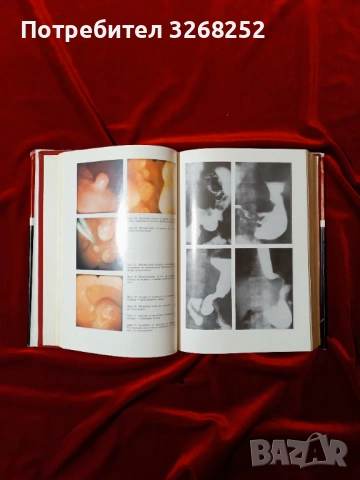 Учебник по Гастроентерология , снимка 4 - Учебници, учебни тетрадки - 53969956