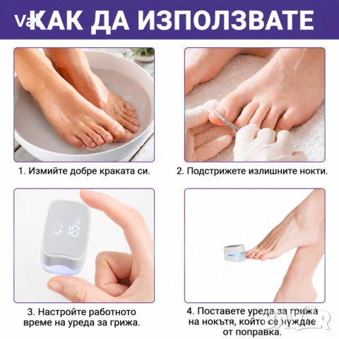 Уред за лазерно лечение на гъбички по ноктите, снимка 7 - Други - 54543027