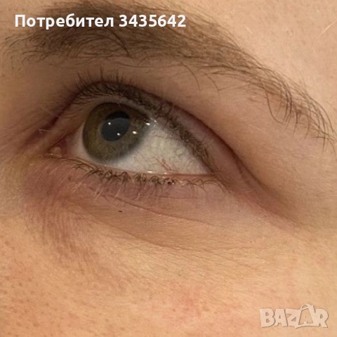  Серум против бръчки, торбички под очите, снимка 2 - Козметика за лице - 53950445