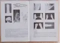 Хирургия на ръката , снимка 4