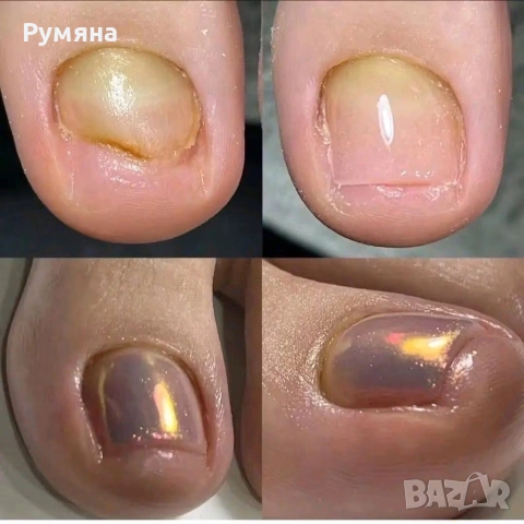 Пчелен мехлем срещу гъбички по ноктите , снимка 2 - Други - 54932823