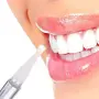 Teeth Whitening Pen Избелваща писалка за зъби, снимка 1