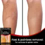 Здравен пластир за лечение на разширени вени Varicose Care Health Patch 12бр, снимка 2