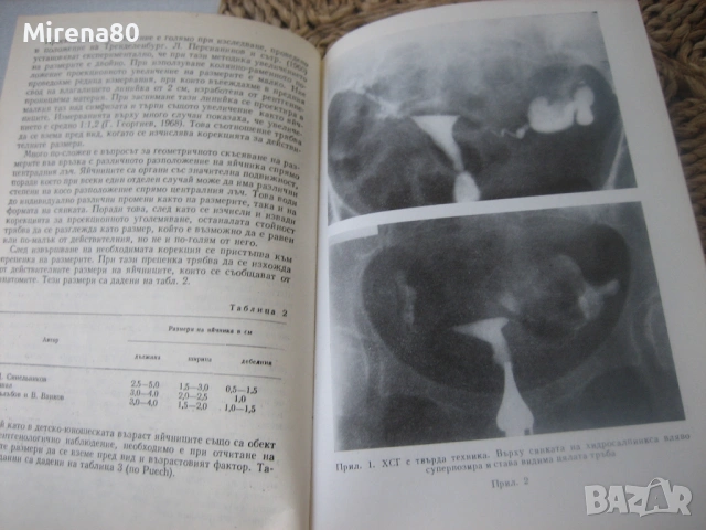 Рентгенова диагностика в гинекологията, снимка 4 - Специализирана литература - 53967170