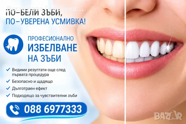 Избелване и почистване на вашите зъби в 1 посещение, снимка 2 - Медицински, стоматологични - 55631905