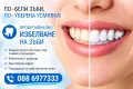 Избелване и почистване на вашите зъби в 1 посещение, снимка 2