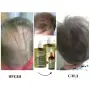 Комплект за бърз растеж за коса *Bio Rehab***, снимка 1
