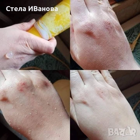пилинг с лимон за дълбоко почистване на кожата, изравняване на тена и релефа, пигментация, белези, снимка 7 - Козметика за лице - 54924507