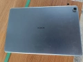 За части всичко работи без дисплея. Honor Pad X8 10.1 inch AGM3-W09HN Wifi 128GB (6GB RAM)., снимка 2