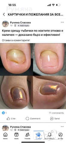 Пчелен мехлем срещу гъбички по ноктите , снимка 2 - Други - 54932823