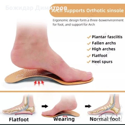 ортопедични стелки, снимка 4 - Ортопедични стелки - 54236502