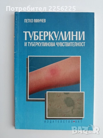 Туберкулини и туберкулинова чувствителност
