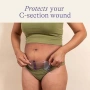Нови C-section хидрогелни падове Lansinoh за следродилна грижа лепенки след секцио охлаждащи, снимка 3