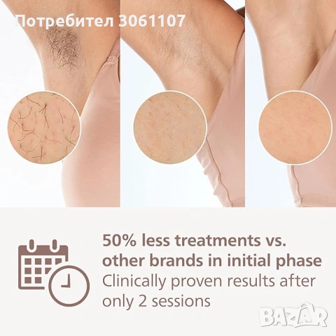 Фотоепилатор за обезкосмяване Philips Lumea IPL 8000 Series SenseIQ BRI948/00, снимка 3 - Други - 54538585