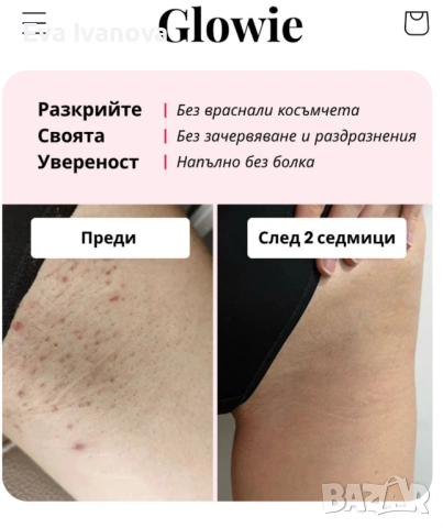 Фотоепилатор Glowie , снимка 3 - Епилатори - 54883108