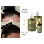 Комплект за бърз растеж за коса *Bio Rehab***, снимка 2