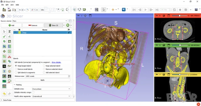 Медицинско 3D моделиране - 3D Slicer за начинаещи