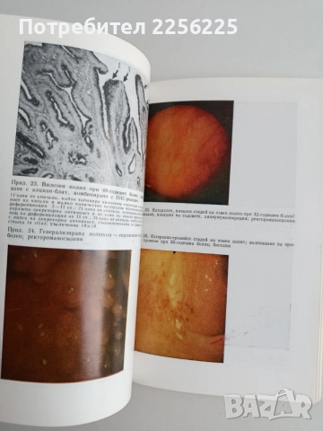 Клинична профилактика на рака на колона и ректума, снимка 4 - Специализирана литература - 54825557