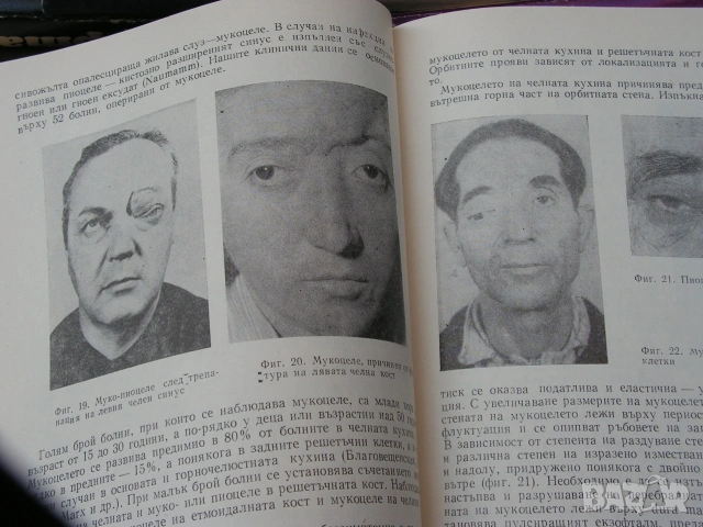 Офтамология , лот от уччебници и специализирана литература., снимка 6 - Учебници, учебни тетрадки - 55250988