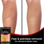Пластири за разширени вени Varicose Care – 12 броя, снимка 6