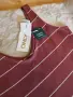 Рокля Only, XS размер, снимка 6