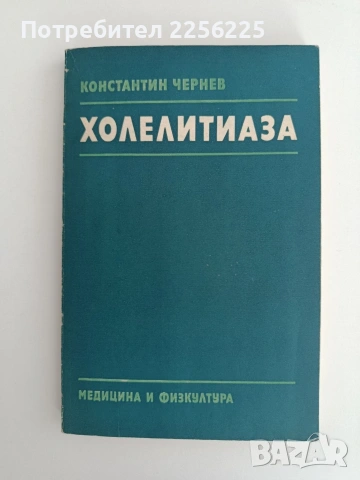 Холелитиаза