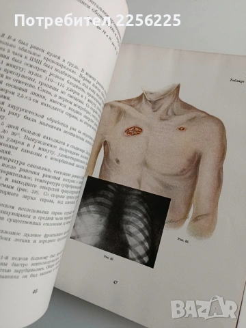 Атлас на огнестрелните ранения ( том 2 и 3), снимка 2 - Специализирана литература - 54436168