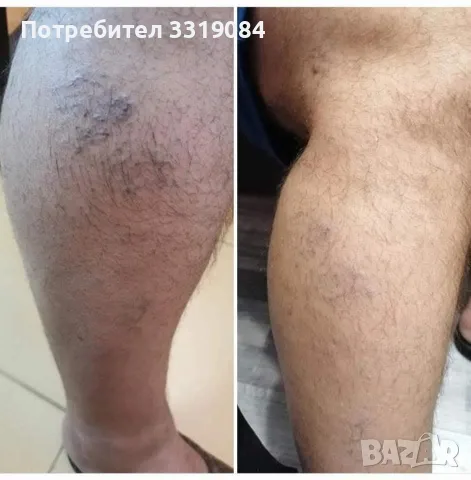 ФИТОГЕЛ Славитон , снимка 5 - Други - 55455511