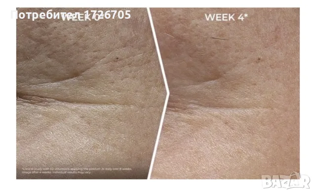 НОВ Eucerin Hyaluron-Filler Epigenetic Serum , снимка 2 - Козметика за лице - 55546710
