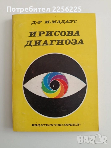 Ирисова диагноза