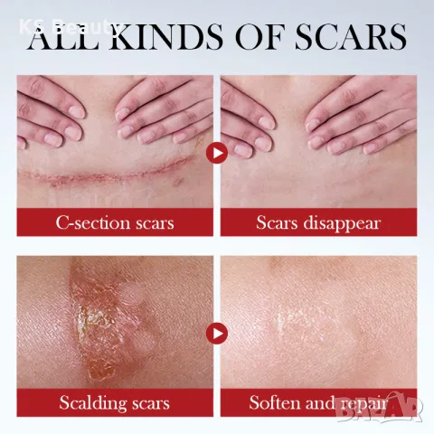 Sadoer Scar Repair Serum - серум за премахване на белези