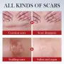 Sadoer Scar Repair Serum - серум за премахване на белези, снимка 1
