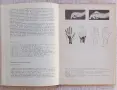 Хирургия на ръката , снимка 5