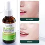 Sadoer Oil Control Salycilic Acid - есенция против акне, снимка 4