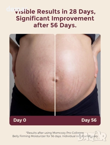 Крем против стрии Momcozy за бременност, стягащ хидратиращ крем с про-колаген, 30 грама, снимка 12 - Козметика за тяло - 54027770