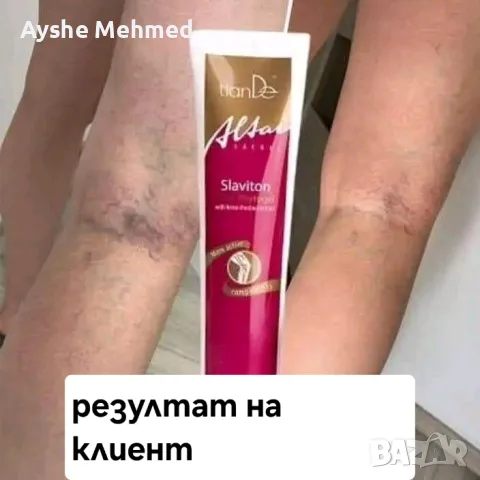Фитогел за крака „Славитон“ Фитогел за крака „Славитон” подобрява кръвообращението, укрепва стените , снимка 4 - Други - 55703434