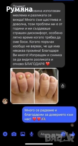 Пчелен мехлем срещу гъбички по ноктите , снимка 6 - Други - 54932823