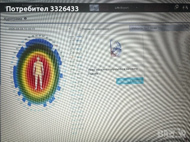 Биорезонанс - диагностика и терапия , снимка 8 - Медицински, стоматологични - 54220027