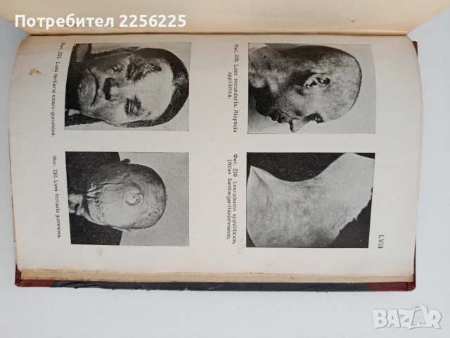 Кожни и венерични болести 1946г, снимка 8 - Специализирана литература - 54928425