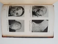 Кожни и венерични болести 1946г, снимка 8