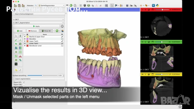 Медицинско 3D моделиране - 3D Slicer за начинаещи, снимка 5 - IT/Компютърни - 54755881