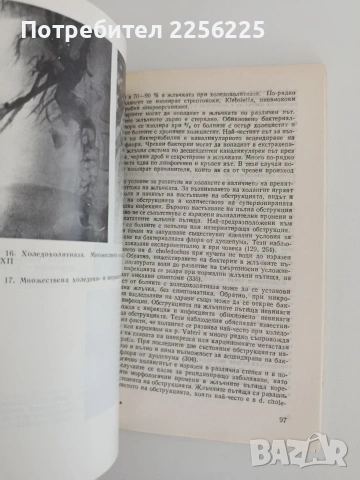Холелитиаза, снимка 2 - Специализирана литература - 54836427