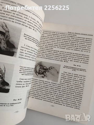 Цезарово сечение, снимка 4 - Специализирана литература - 55162822