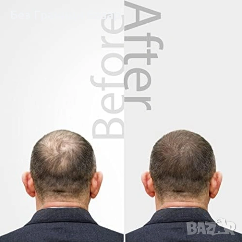 Ново Подхранващо масло за скалп и коса за по-плътна визия Mossi London озонирано 30 мл, снимка 6 - Продукти за коса - 54132990